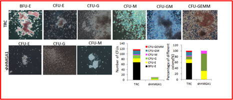 Immune Mediated ITP